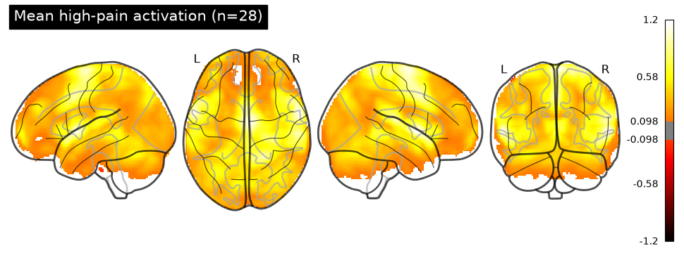 <Figure size 950x350 with 6 Axes>